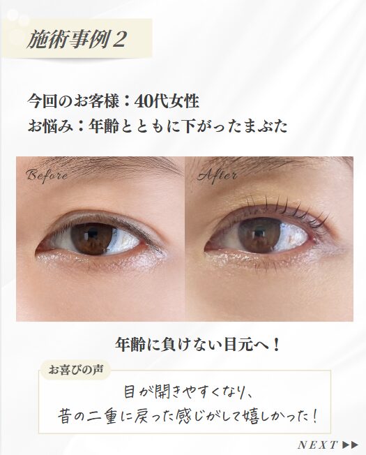 40代・50代のまつ毛パーマと目元の変化